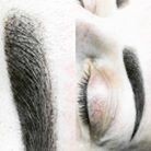 Yearly Refresher Booster – Micropigmentation