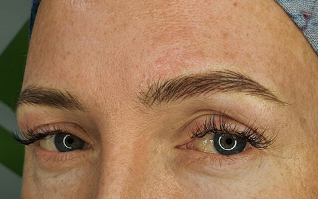 18-24 months Top Up -Corrective