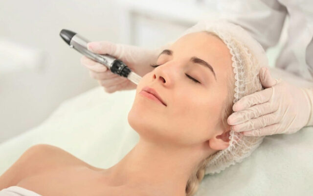 Microneedling – Collagen Induction Therapy