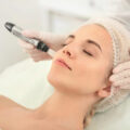 Microneedling – Collagen Induction Therapy
